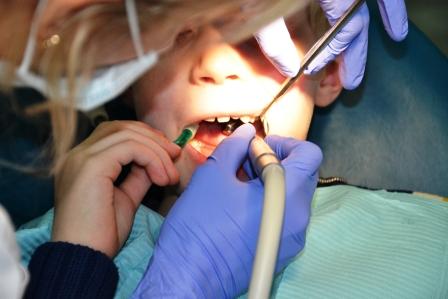 Удаление разрушенного молочного зуба